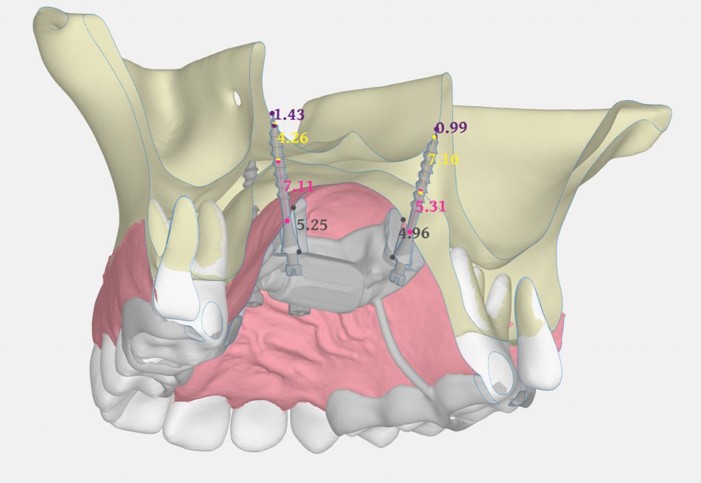 Visor 3D Interactivo de Ortoplus
